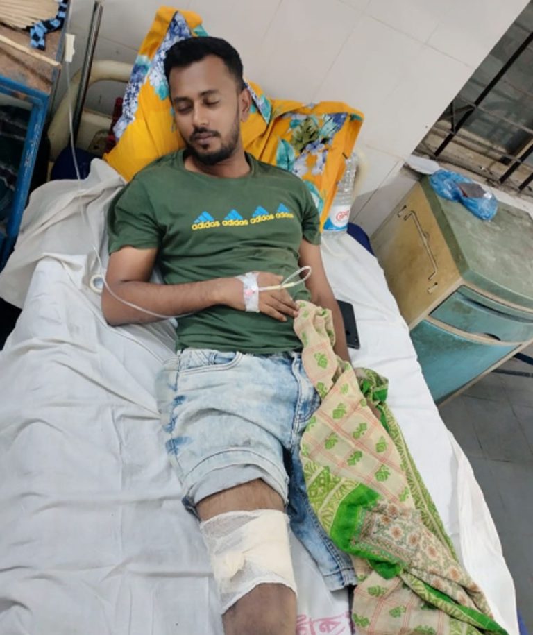 ভাগ্নে গুলি করার অভিযোগ, এয়ারগানসহ মামা গ্রেফতার